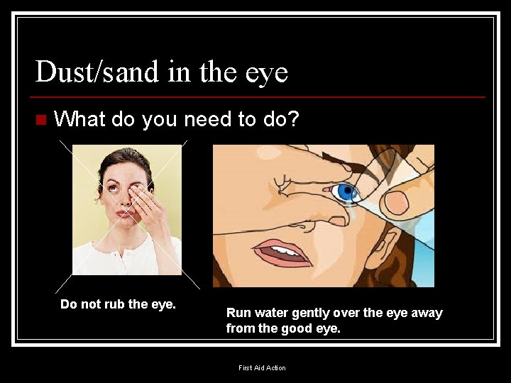 Dust/sand in the eye n What do you need to do? Do not rub