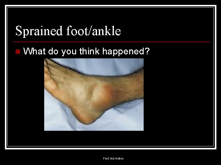 Sprained foot/ankle n What do you think happened? First Aid Action 