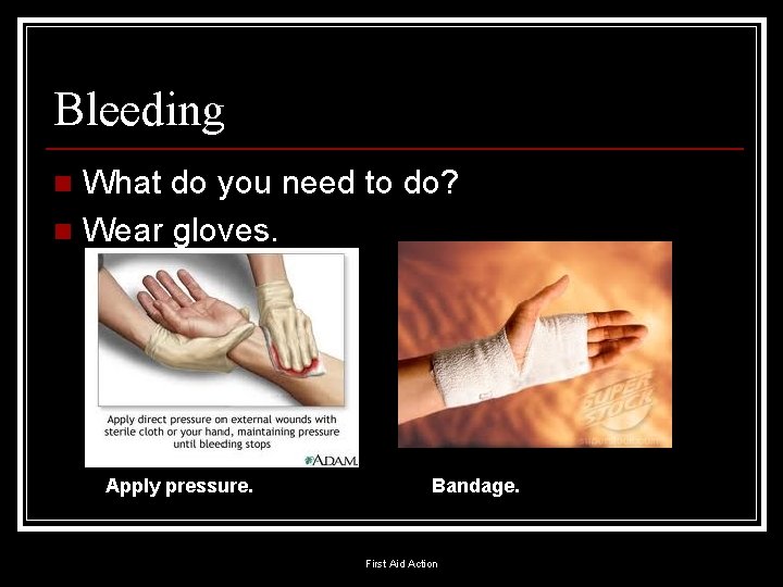 Bleeding What do you need to do? n Wear gloves. n Apply pressure. Bandage.