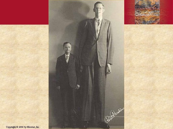 Copyright © 2006 by Elsevier, Inc. 