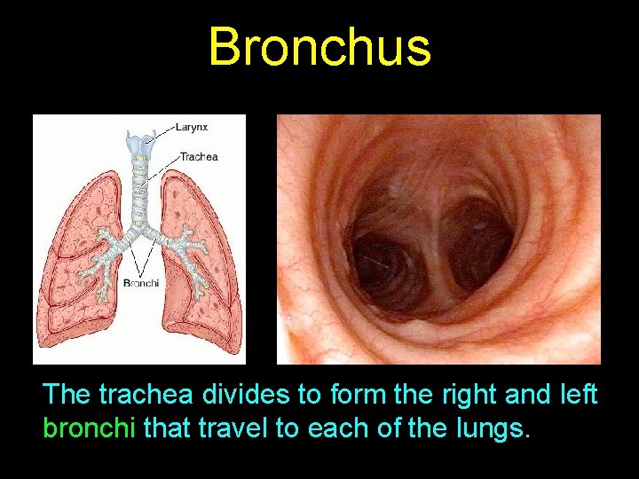 Bronchus The trachea divides to form the right and left bronchi that travel to