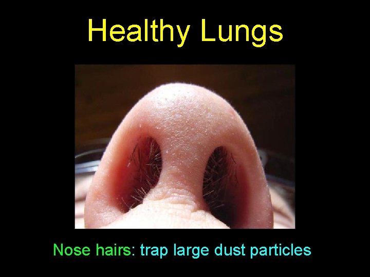 Healthy Lungs Nose hairs: trap large dust particles 