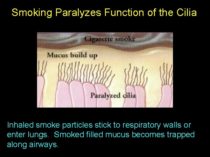 Smoking Paralyzes Function of the Cilia Inhaled smoke particles stick to respiratory walls or