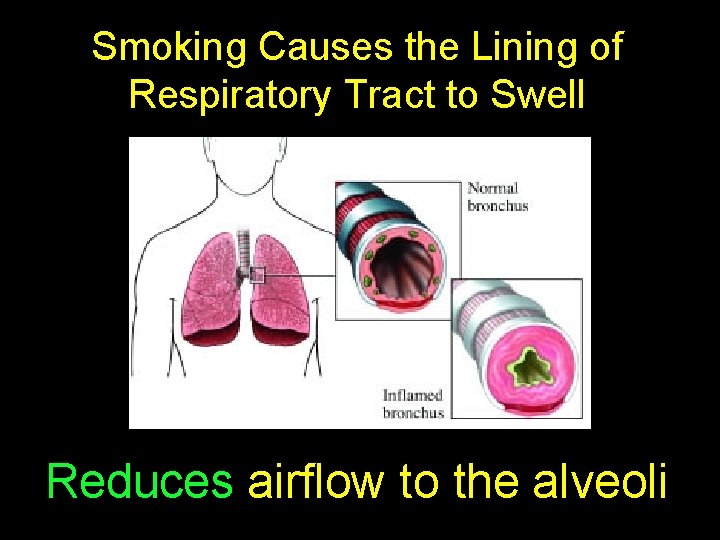 Smoking Causes the Lining of Respiratory Tract to Swell Reduces airflow to the alveoli