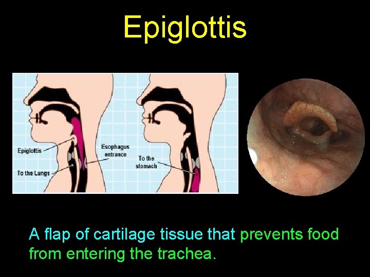 Epiglottis A flap of cartilage tissue that prevents food from entering the trachea. 