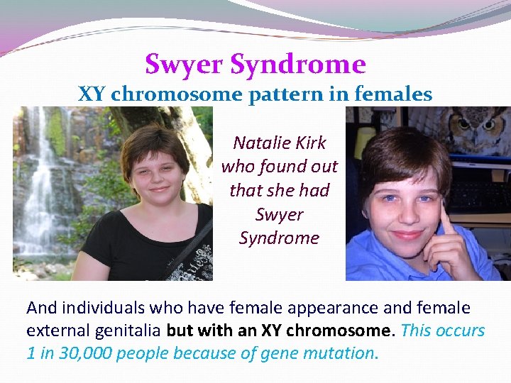 Swyer Syndrome XY chromosome pattern in females Natalie Kirk who found out that she Swyer Syndrome XY chromosome pattern in females Natalie Kirk who found out that she