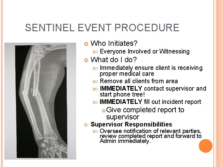SENTINEL EVENT PROCEDURE Who Initiates? Everyone Involved or Witnessing What do I do? Immediately
