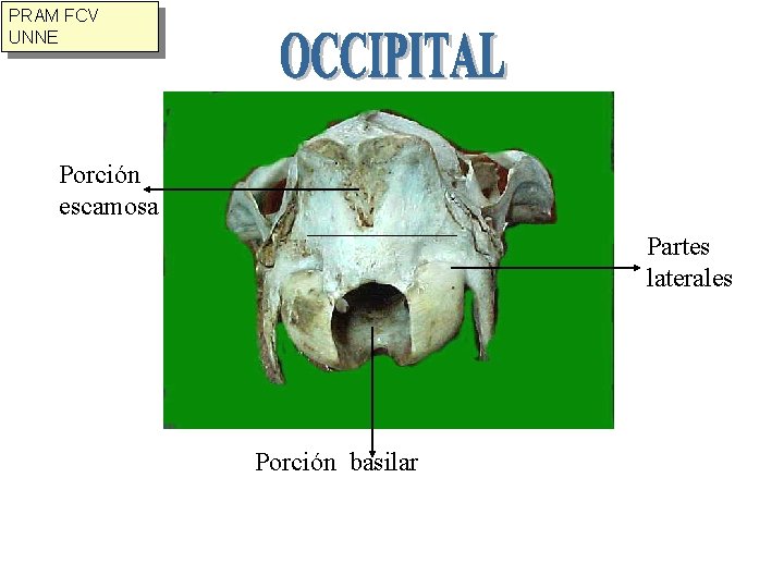 PRAM FCV UNNE Porción escamosa Partes laterales Porción basilar 