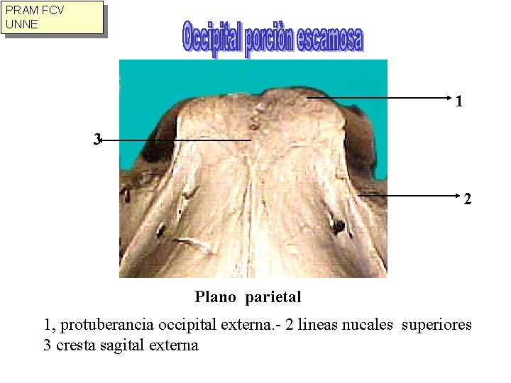 PRAM FCV UNNE 1 3 2 Plano parietal 1, protuberancia occipital externa. - 2