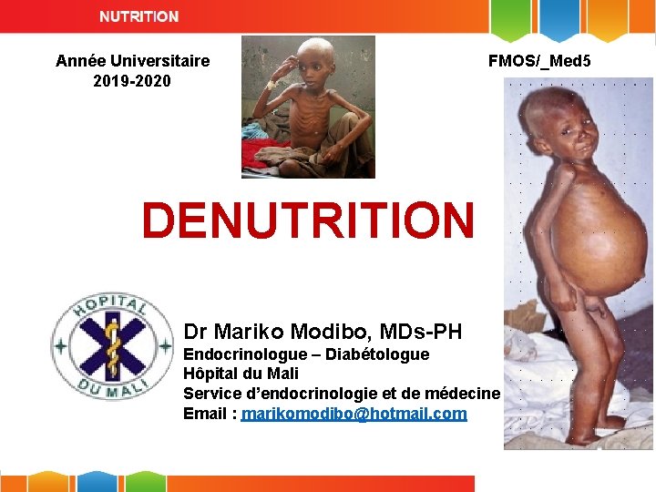 Année Universitaire 2019 -2020 FMOS/_Med 5 DENUTRITION Dr Mariko Modibo, MDs-PH Endocrinologue – Diabétologue