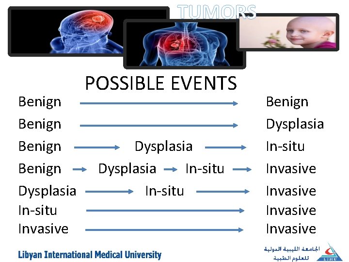 TUMORS Benign Dysplasia In-situ Invasive POSSIBLE EVENTS Dysplasia In-situ Benign Dysplasia In-situ Invasive 