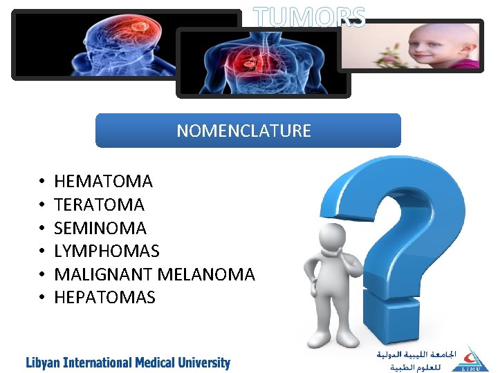 TUMORS NOMENCLATURE • • • HEMATOMA TERATOMA SEMINOMA LYMPHOMAS MALIGNANT MELANOMA HEPATOMAS 