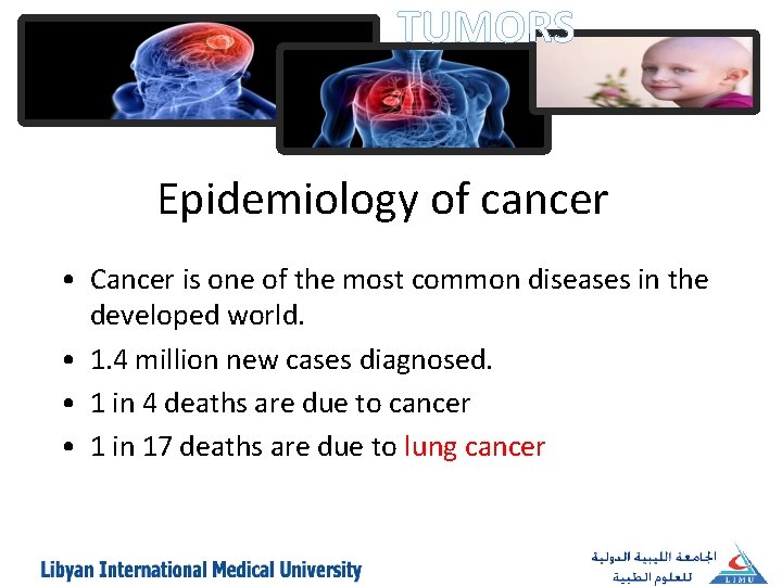 TUMORS Epidemiology of cancer • Cancer is one of the most common diseases in