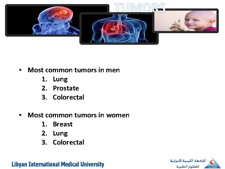 TUMORS • Most common tumors in men 1. Lung 2. Prostate 3. Colorectal •