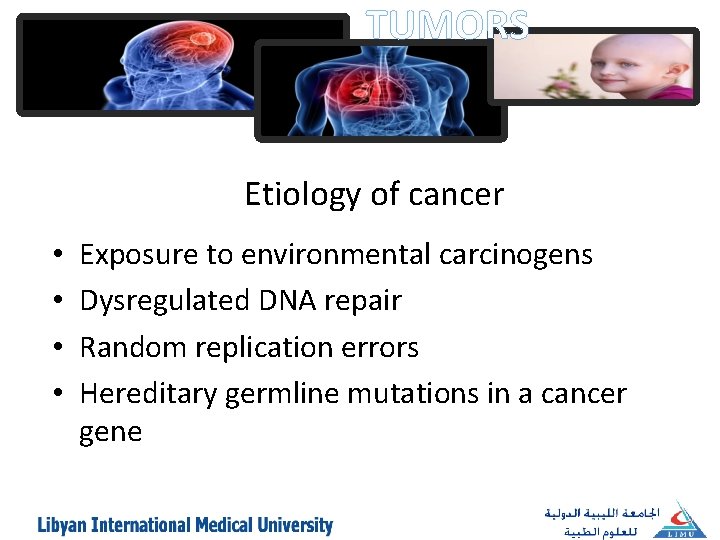 TUMORS Etiology of cancer • • Exposure to environmental carcinogens Dysregulated DNA repair Random