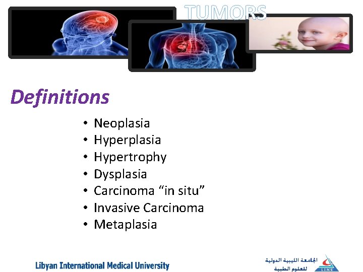 TUMORS Definitions • • Neoplasia Hypertrophy Dysplasia Carcinoma “in situ” Invasive Carcinoma Metaplasia 