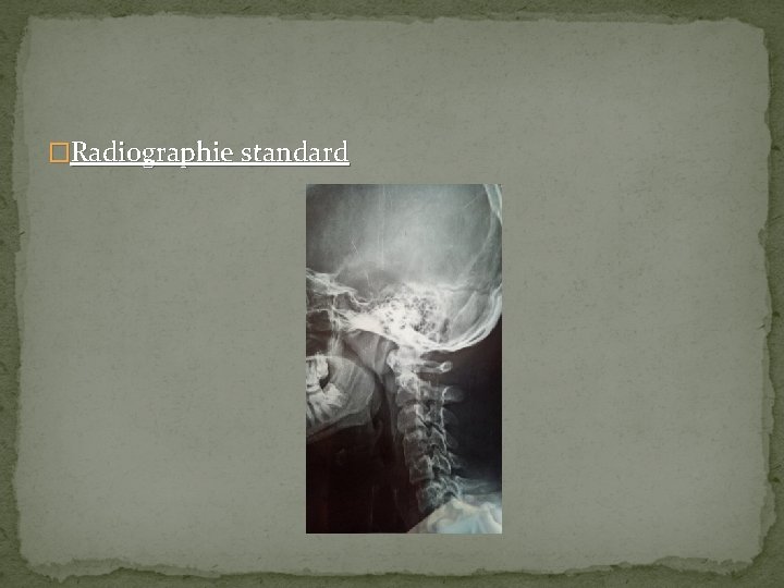 �Radiographie standard 