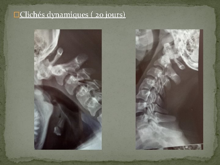 �Clichés dynamiques ( 20 jours) 