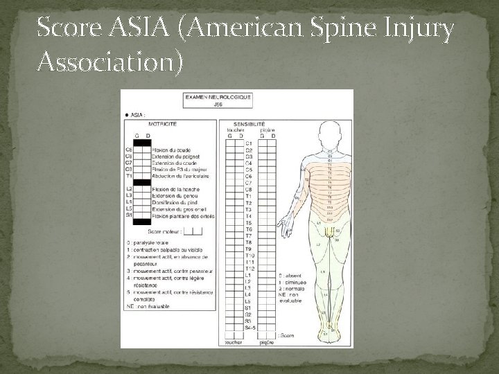 Score ASIA (American Spine Injury Association) 