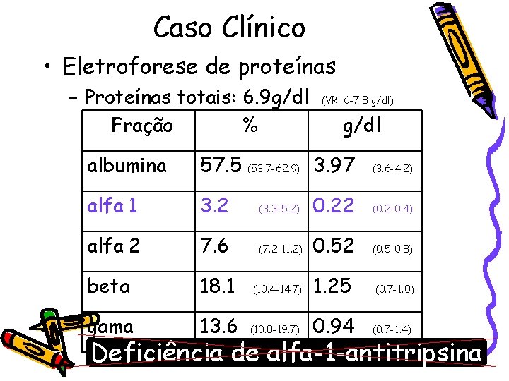 Caso Clínico • Eletroforese de proteínas – Proteínas totais: 6. 9 g/dl Fração %