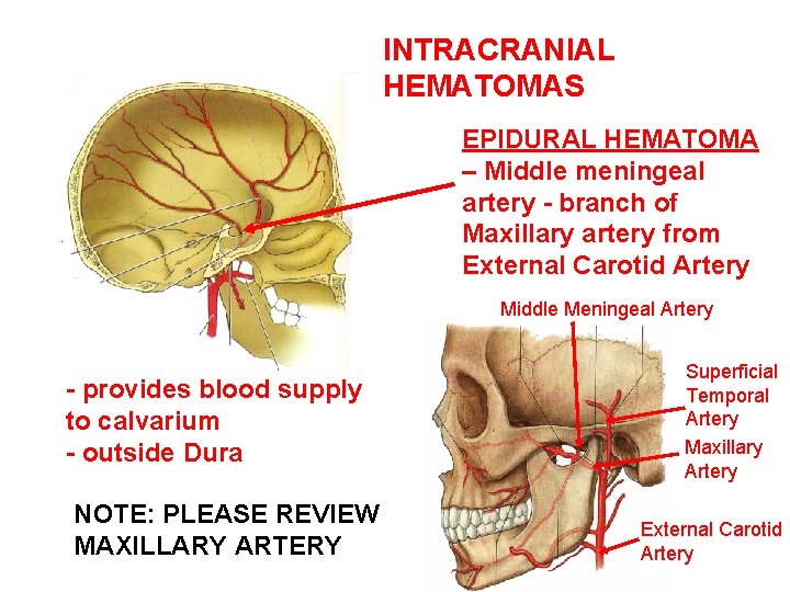 INTRACRANIAL HEMATOMAS EPIDURAL HEMATOMA – Middle meningeal artery - branch of Maxillary artery from