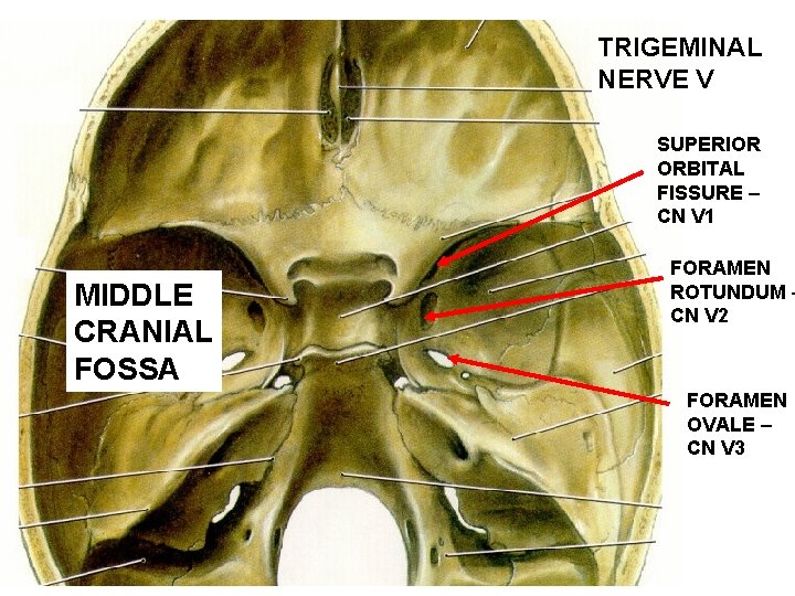 TRIGEMINAL NERVE V SUPERIOR ORBITAL FISSURE – CN V 1 MIDDLE CRANIAL FOSSA FORAMEN