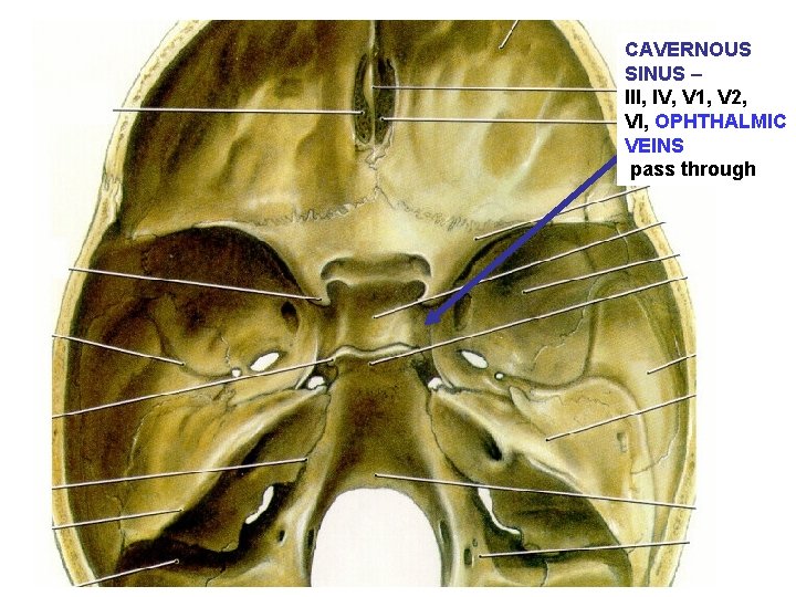 CAVERNOUS SINUS – III, IV, V 1, V 2, VI, OPHTHALMIC VEINS pass through