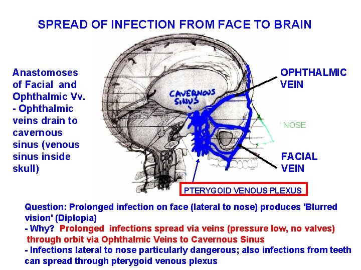 SPREAD OF INFECTION FROM FACE TO BRAIN Anastomoses of Facial and Ophthalmic Vv. -