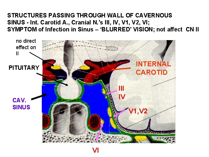 STRUCTURES PASSING THROUGH WALL OF CAVERNOUS SINUS - Int. Carotid A. , Cranial N.