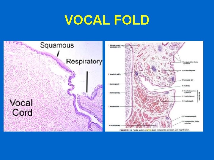 VOCAL FOLD 