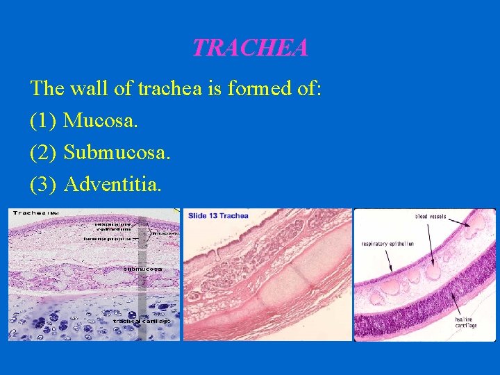TRACHEA The wall of trachea is formed of: (1) Mucosa. (2) Submucosa. (3) Adventitia.