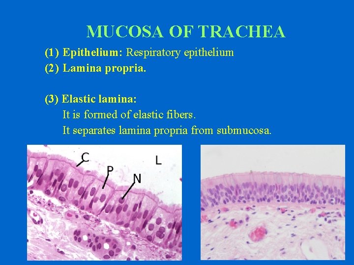 MUCOSA OF TRACHEA (1) Epithelium: Respiratory epithelium (2) Lamina propria. (3) Elastic lamina: It
