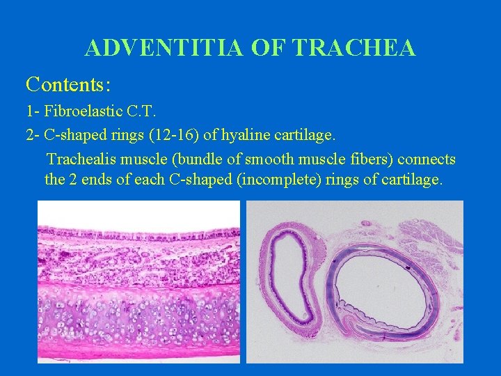 ADVENTITIA OF TRACHEA Contents: 1 - Fibroelastic C. T. 2 - C-shaped rings (12