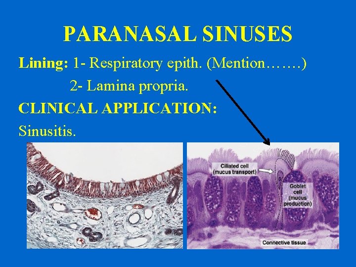 PARANASAL SINUSES Lining: 1 - Respiratory epith. (Mention……. ) 2 - Lamina propria. CLINICAL