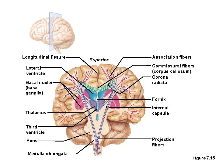 Longitudinal fissure Lateral ventricle Basal nuclei (basal ganglia) Superior Association fibers Commissural fibers (corpus