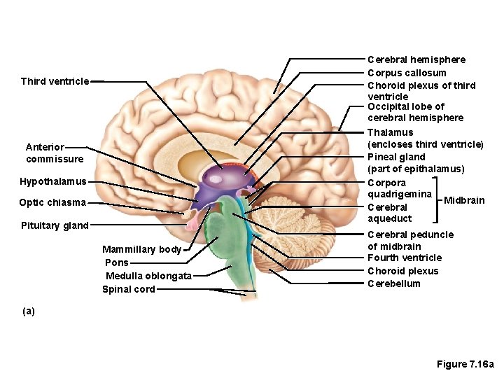 Cerebral hemisphere Corpus callosum Choroid plexus of third ventricle Occipital lobe of cerebral hemisphere