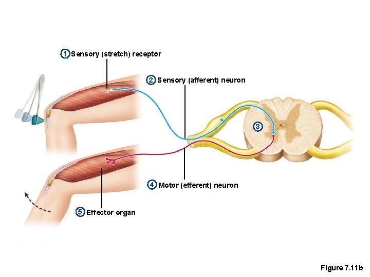 1 Sensory (stretch) receptor 2 Sensory (afferent) neuron 3 4 Motor (efferent) neuron 5
