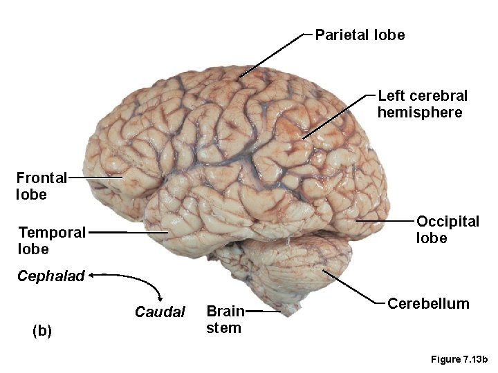 Parietal lobe Left cerebral hemisphere Frontal lobe Occipital lobe Temporal lobe Cephalad Caudal (b)