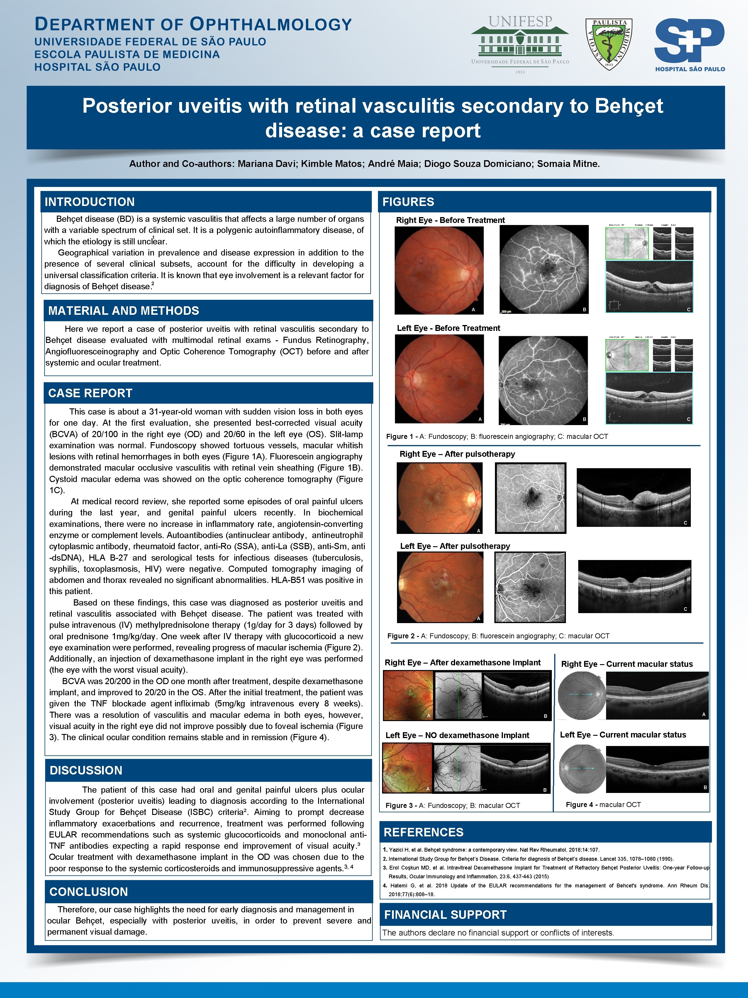 Posterior uveitis with retinal vasculitis secondary to Behçet disease: a case report Author and
