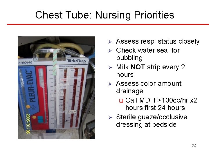 Chest Tube: Nursing Priorities Ø Ø Ø Assess resp. status closely Check water seal