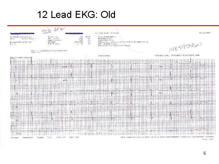 12 Lead EKG: Old 6 