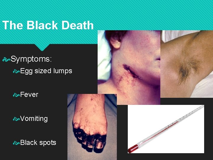 The Black Death Symptoms: Egg sized lumps Fever Vomiting Black spots 
