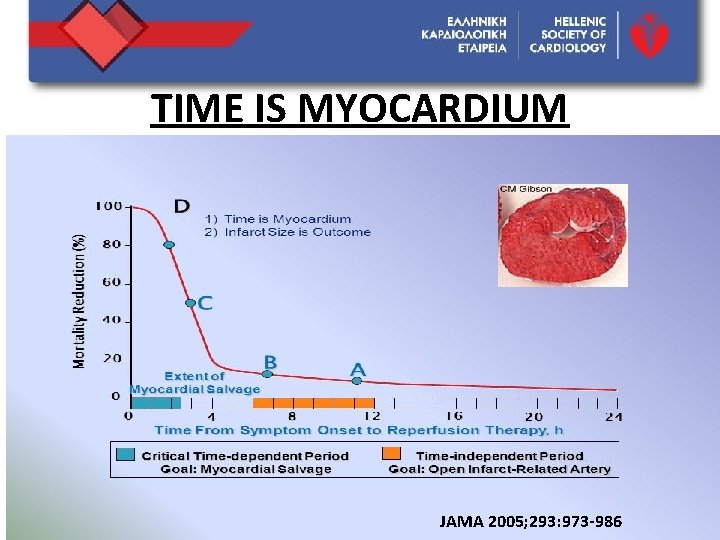 TIME IS MYOCARDIUM DISCLOSURE JAMA 2005; 293: 973 -986 