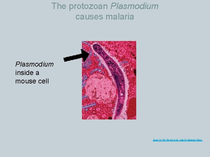 The protozoan Plasmodium causes malaria Plasmodium inside a mouse cell Image by Ute Frevert;