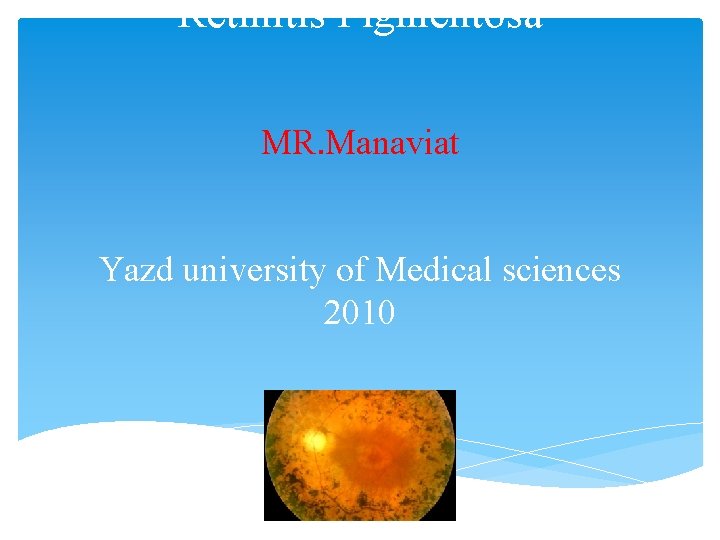 Retinitis Pigmentosa MR. Manaviat Yazd university of Medical sciences 2010 