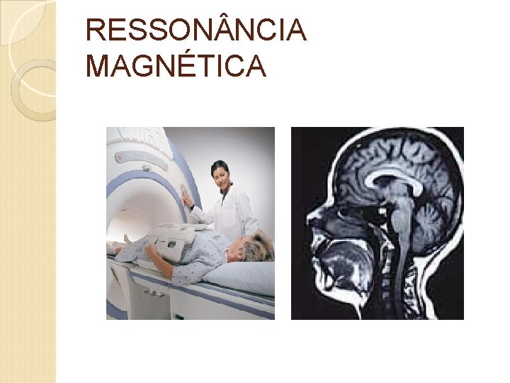 RESSON NCIA MAGNÉTICA 