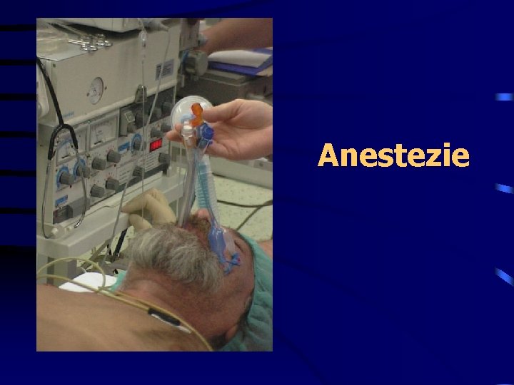 Anestezie 
