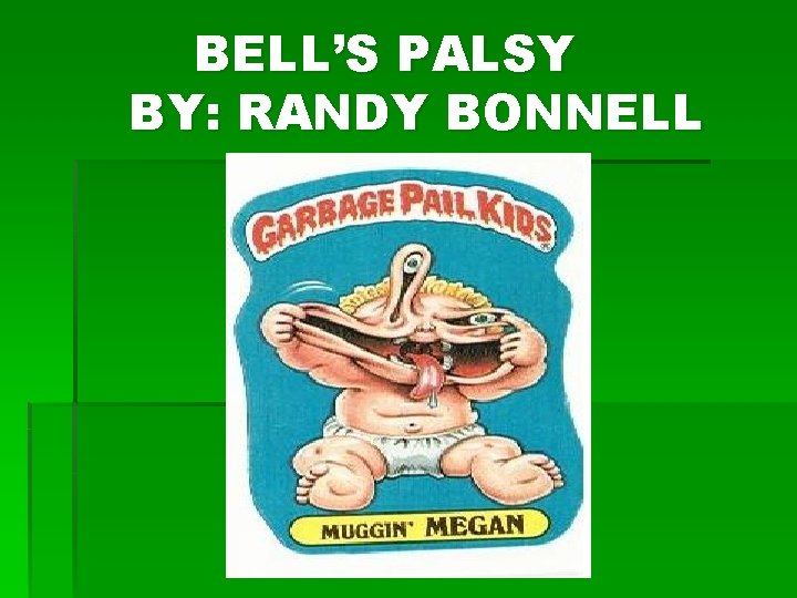 BELL’S PALSY BY: RANDY BONNELL 