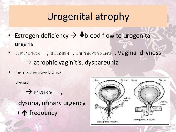 Urogenital atrophy • Estrogen deficiency blood flow to urogenital organs • ผวหนงบางลง , ขนนอยลง