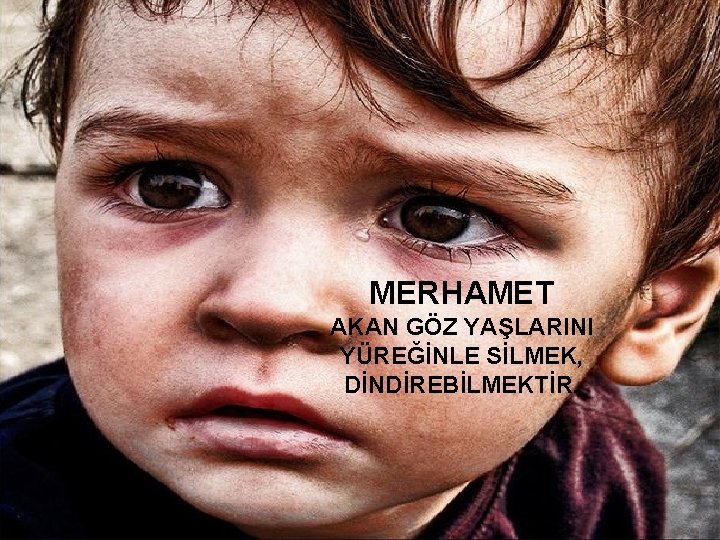 MERHAMET AKAN GÖZ YAŞLARINI YÜREĞİNLE SİLMEK, DİNDİREBİLMEKTİR. 